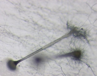 Microscopia e........MICRO funghi (muffe)